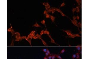 Immunofluorescence analysis of NIH/3T3 cells using SLC25A38 Polyclonal Antibody at dilution of 1:100.