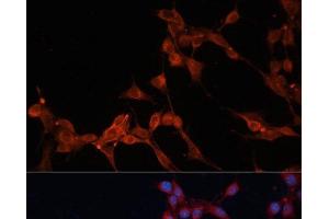 Immunofluorescence analysis of NIH/3T3 cells using SLC25A38 Polyclonal Antibody at dilution of 1:100. (SLC25A38 anticorps)