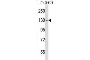 Western Blotting (WB) image for anti-TBC1 Domain Family, Member 2 (TBC1D2) antibody (ABIN5019936) (TBC1D2 anticorps)