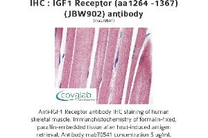 Image no. 1 for anti-Insulin-Like Growth Factor 1 Receptor (IGF1R) (AA 1264-1367) antibody (ABIN1723400)