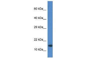 WB Suggested Anti-Rnf122 Antibody   Titration: 1. (RNF122 anticorps  (Middle Region))