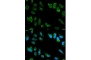Immunofluorescence analysis of MCF7 cell using IL1RN antibody. (IL1RN anticorps)