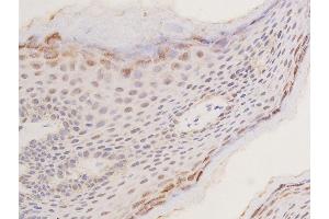 ABIN6267288 at 1/100 staining human skin tissue sections by IHC-P.
