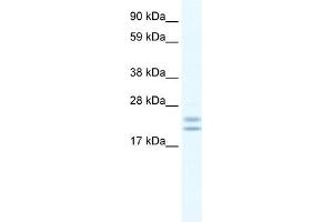 WB Suggested Anti-Tppp Antibody Titration:  0. (Tppp anticorps  (C-Term))