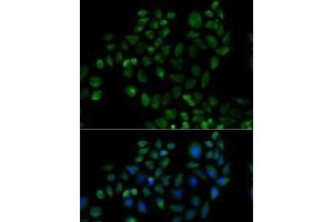 Immunofluorescence analysis of HeLa cells using FABP2 Polyclonal Antibody (FABP2 anticorps)