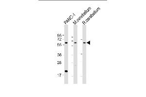 All lanes : Anti-SLC11A2 Antibody (Center) at 1:2000 dilution Lane 1: NC-1 whole cell lysate Lane 2: mouse cerebellum lysate Lane 3: rat cerebellum lysate Lysates/proteins at 20 μg per lane. (SLC11A2 anticorps  (AA 262-291))
