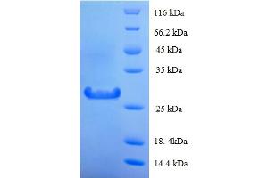 SDS-PAGE (SDS) image for Protein Tyrosine Phosphatase, Receptor-Type, Z Polypeptide 2 (PTPRZ2) (AA 36-300) protein (His tag) (ABIN5713774) (PTPRZ Protein (AA 36-300) (His tag))