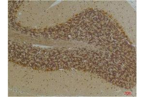 Immunohistochemical analysis of paraffin-embedded Human BrainTissue using KCNN2(SK2) Rabbit pAb diluted at 1:200. (KCNN2 anticorps)