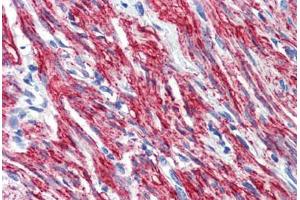 Human Uterus, Myometrium (formalin-fixed, paraffin-embedded) stained with PNPT1 antibody ABIN462230 followed by biotinylated goat anti-rabbit IgG secondary antibody ABIN481713, alkaline phosphatase-streptavidin and chromogen.