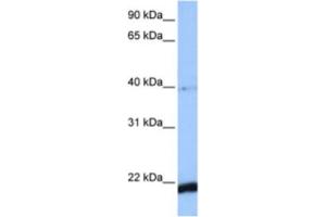 Western Blotting (WB) image for anti-HBS1-Like (HBS1L) antibody (ABIN2463501) (HBS1L anticorps)