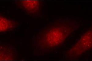 Immunofluorescence staining of methanol-fixed Hela cells, using Phospho-RB1-S780 antibody. (Retinoblastoma 1 anticorps  (pSer780))