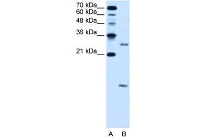 WB Suggested Anti-VMA21 Antibody Titration:  5. (VMA21 anticorps  (N-Term))