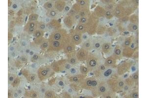 Detection of FASL in Human Liver Tissue using Polyclonal Antibody to Factor Related Apoptosis Ligand (FASL)