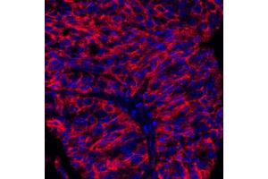 Immunofluorescence (IF) image for anti-CD276 (CD276) (C-Term) antibody (ABIN7455195)