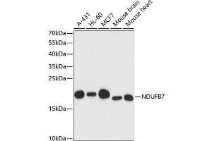 Western blot analysis of extracts of various cell lines using NDUFB7 Polyclonal Antibody at dilution of 1:3000. (NDUFB7 anticorps)
