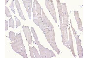 IHC analysis of PCDH15 using anti-PCDH15 antibody (ABIN6719362). (PCDH15 anticorps)