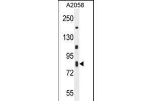C6orf70 Antibody (Center) (ABIN654987 and ABIN2844625) western blot analysis in  cell line lysates (35 μg/lane). (C6orf70 anticorps  (AA 346-375))