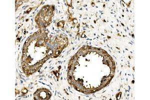 IHC analysis of MSN using anti-MSN antibody (ABIN7600378). (Moesin anticorps  (AA 184-568))