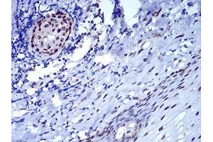 Immunohistochemical analysis of paraffin-embedded esophagus tissues using CBX5 mouse mAb with DAB staining.