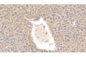 Detection of LCAT in Mouse Liver Tissue using Polyclonal Antibody to Lecithin Cholesterol Acyltransferase (LCAT) (LCAT anticorps  (AA 290-432))