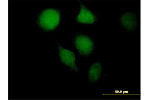 Immunofluorescence of purified MaxPab antibody to OGG1 on HeLa cell.