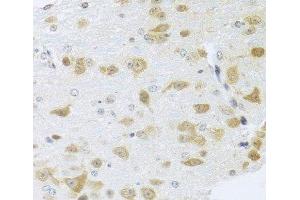 Immunohistochemistry of paraffin-embedded Mouse brain using Gm13125 Polyclonal Antibody at dilution of 1:100 (40x lens). (Pramel15 anticorps)
