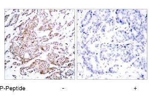 Image no. 1 for anti-Myc Proto-Oncogene protein (MYC) (pThr58) antibody (ABIN196672) (c-MYC anticorps  (pThr58))