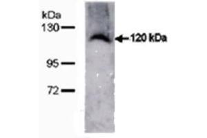 Image no. 4 for anti-Transmembrane Protein 67 (TMEM67) (C-Term) antibody (ABIN347657) (TMEM67 anticorps  (C-Term))