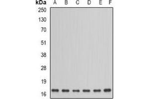 Western blot analysis of NDUFA12 expression in HepG2 (A), PC12 (B), mouse kidney (C), mouse testis (D), rat heart (E), rat brain (F) whole cell lysates. (NDUFA12 anticorps)