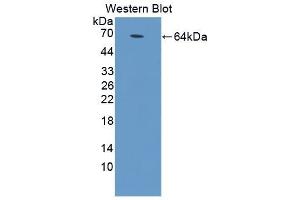 Detection of Recombinant MyD88, Rat using Polyclonal Antibody to Myeloid Differentiation Factor 88 (MyD88) (MYD88 anticorps  (AA 1-296))