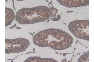 Figure. (TUBD1 anticorps  (AA 238-482))