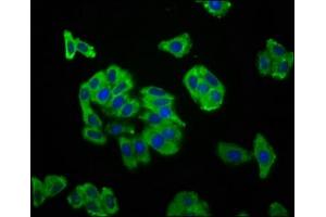 Immunofluorescence staining of HepG2 cells with ABIN7169920 at 1:166, counter-stained with DAPI. (SCN11A anticorps  (AA 403-551))