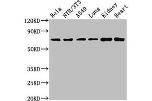 Western Blot Positive WB detected in: Hela whole cell lysate, NIH/3T3 whole cell lysate, A549 whole cell lysate, Rat lung tissue, Rat kidney tissue, Mouse heart tissue All lanes: ARHGAP18 antibody at 4. (ARHGAP18 anticorps  (AA 389-577))