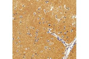 anti-KISS1 Receptor (KISS1R) (AA 60-373) antibody