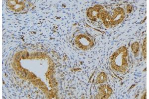ABIN6276486 at 1/100 staining Human uterus tissue by IHC-P. (RNASE12 anticorps  (Internal Region))