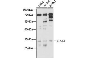 Western blot analysis of extracts of various cell lines, using CPSF4 antibody (ABIN6130128, ABIN6138972, ABIN6138973 and ABIN6214478) at 1:1000 dilution. (CPSF4 anticorps  (AA 1-244))