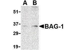 Western Blotting (WB) image for anti-BCL2-Associated Athanogene (BAG1) (N-Term) antibody (ABIN2477577) (BAG1 anticorps  (N-Term))