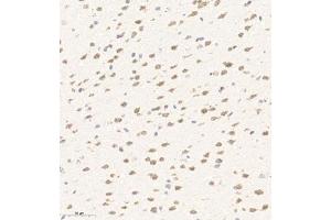 Immunohistochemistry of paraffin embedded mouse brain using AZI2 (ABIN7072856) at dilution of 1:650 (300x lens) (AZI2 anticorps)