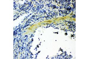 Anti- Gelsolin antibody, IHC(P) IHC(P): Mouse Spleen Tissue (Gelsolin anticorps  (AA 580-782))