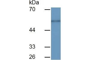 Detection antibody from the kit in WB with Positive Control:  Sample Mouse Serum.