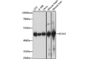 Western blot analysis of extracts of various cell lines, using  antibody (ABIN7265368) at 1:1000 dilution. (ACAA2 anticorps  (AA 1-250))