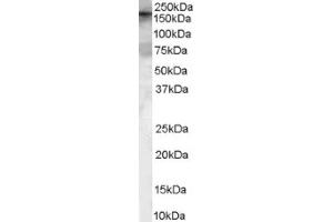 Image no. 1 for anti-rho Guanine Nucleotide Exchange Factor (GEF) 5 (ARHGEF5) (Internal Region) antibody (ABIN374647) (ARHGEF5 anticorps  (Internal Region))