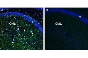 Expression of Secretin Receptor in rat hippocampus - Immunohistochemical staining of perfusion-fixed frozen rat brain sections with Anti-Secretin Receptor (extracellular) Antibody (ABIN7043607, ABIN7044414 and ABIN7044415), (1:200), followed by goat anti-rabbit-AlexaFluor-488. (SCTR anticorps  (Extracellular))