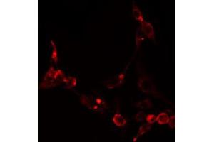 ABIN6274871 staining NIH-3T3 cells by IF/ICC. (Ataxin 2-Like anticorps  (Internal Region))