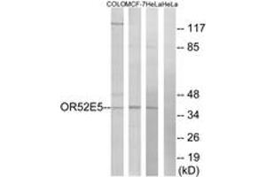 Western blot analysis of extracts from COLO/MCF-7/HeLa cells, using OR52E5 Antibody.