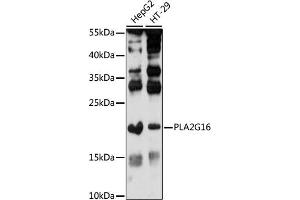 Western blot analysis of extracts of various cell lines, using PLG16 antibody (ABIN7267786) at 1:1000 dilution. (PLA2G16 anticorps  (AA 68-162))