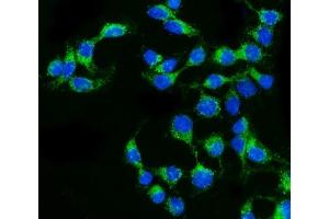IF analysis of Claudin 2/CLDN2 using anti-Claudin 2/CLDN2 antibody (ABIN7602204).