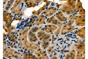 ABIN6264138 and ABIN6273148 at 1/100 staining Rat kidney tissue by IHC-P. (PER2 anticorps  (Internal Region))