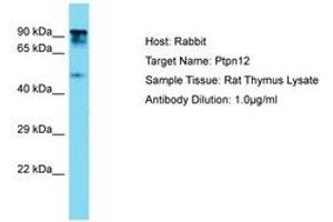 Image no. 1 for anti-Protein Tyrosine Phosphatase G1 (PTPN12) (AA 591-640) antibody (ABIN6750360) (PTPN12 anticorps  (AA 591-640))