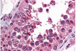 Human Testis: Formalin-Fixed, Paraffin-Embedded (FFPE) (CAMK2B anticorps  (AA 1-504))